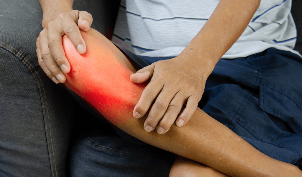 Extremity injury treatment in san antonio, tx