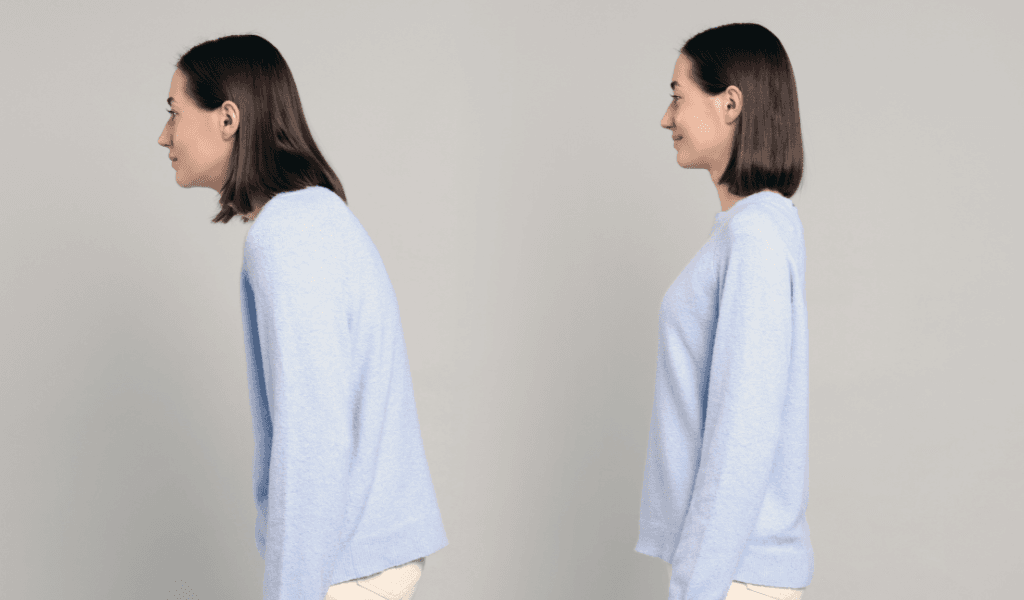 Poor posture treatment in san antonio